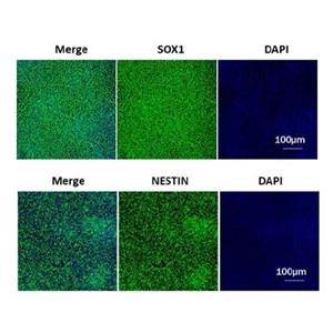 Sonic Hedgehog Protein