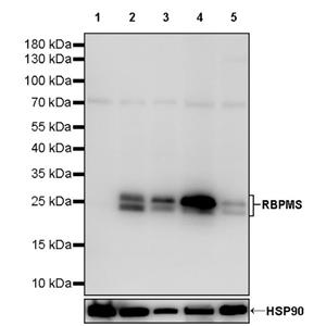 RBPMS Recombinant Rabbit mAb (S-2387-235)