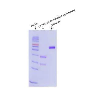 HRV-3C Protease