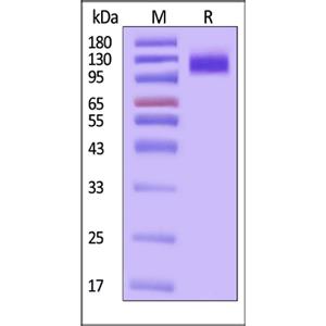 OSMR beta Protein