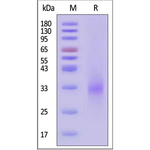 Human NKG2D / CD314 Protein