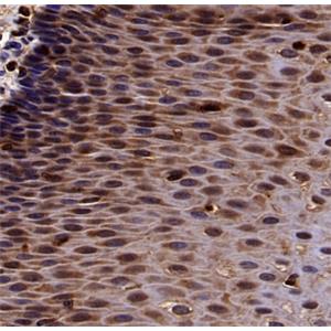 p38 delta/MAPK13 + p38 alpha/MAPK14 Recombinant Mouse mAb (S-3860)