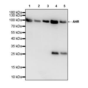 AHR Recombinant Rabbit mAb (S-2370-150)