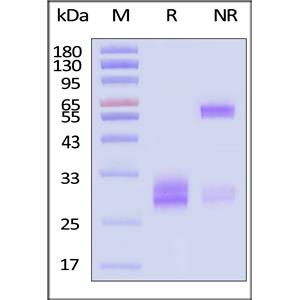 Human CD8 alpha&beta (CD8A&CD8B) Heterodimer Protein