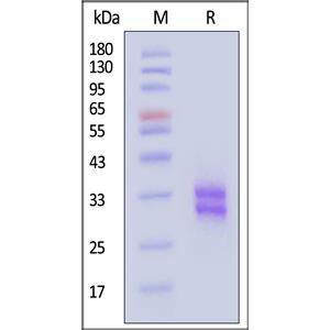 Biotinylated Human CD8 alpha&beta (CD8A&CD8B) Heterodimer Protein