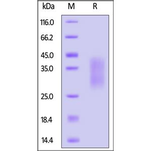 Human HVEM / TNFRSF14 Protein
