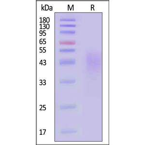 Human DNAM-1 / CD226 Protein