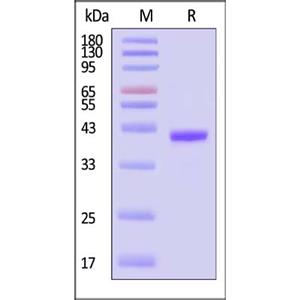 Human CHI3L1 Protein