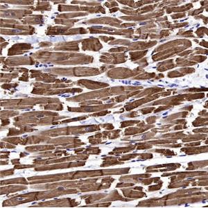 Cardiac troponin T (TNNT2) Recombinant Rabbit mAb ,PBS Only (SDT-2894-34)