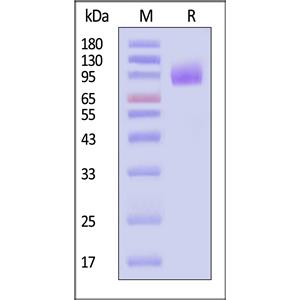 Human CA125 / MUC16 (13810-14451) Protein