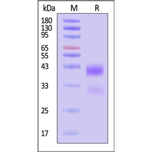 Human Cathepsin B / CTSB Protein