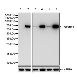 IGF2BP1 Recombinant Rabbit mAb (S-2947-19)