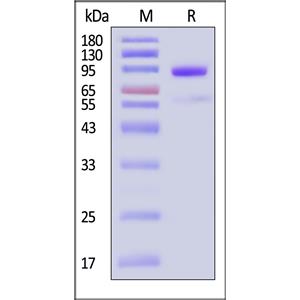 Human NPR3 protein