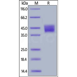 Human Mesothelin / MSLN (296-580) Protein