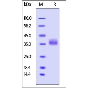 Human Galectin-3 Protein