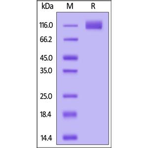 Human PDGF R beta / CD140b Protein