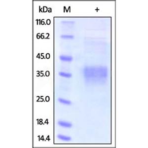 Clusterin / CLUS Protein