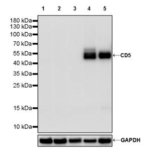 CD5 Recombinant Rabbit mAb ,PBS Only (SDT-2857-16)