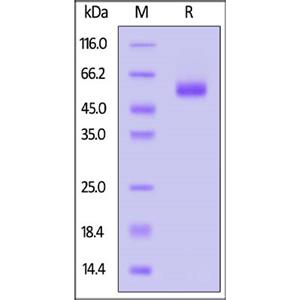 Human IL-18RB Protein
