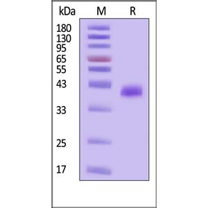 Human CD23 / Fc epsilon RII Protein