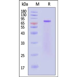 Human Netrin-1 Protein