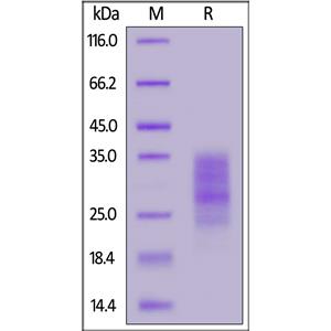 Human Fas / TNFRSF6 / CD95 Protein