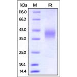 Mouse Fc gamma RIII / CD16 Protein pictures