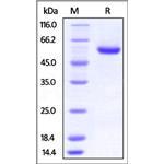 Human ROR2 / NTRKR2 Protein pictures