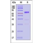 Biotinylated Human Glypican 3 / GPC3 Protein pictures