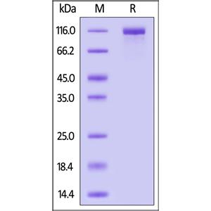 SARS-CoV-2 (COVID-19) S1 protein