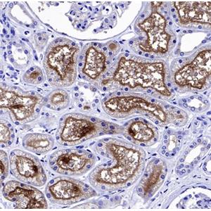 Angiotensin Converting Enzyme 1 Recombinant Rabbit mAb, PBSOnly (SDT-2662-122)