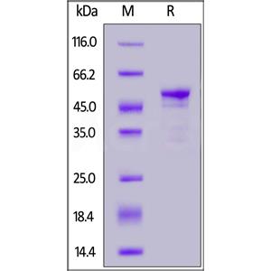 Human Carbonic Anhydrase IX / CA9 (38-414) Protein