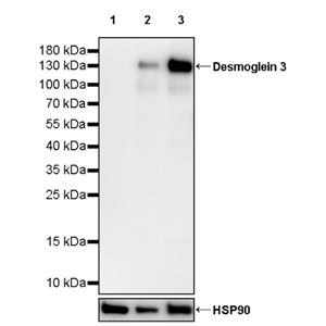 Desmoglein 3 Rabbit Polyclonal Antibody