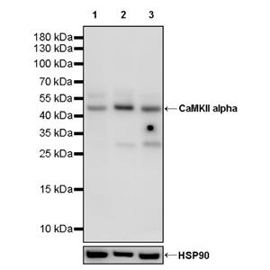 CaMKII alpha Recombinant Rabbit mAb (S-2451-54)