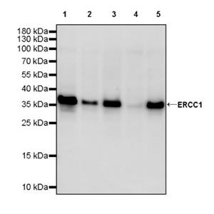 ERCC1 Recombinant Rabbit mAb,PBS Only (SDT-2458-29)