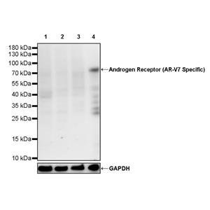 Androgen Receptor (AR-V7 Specific) Recombinant Rabbit mAb (S-2694-53)