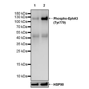 Phospho-EphA3 (Tyr779) Recombinant Rabbit mAb (S-3551)
