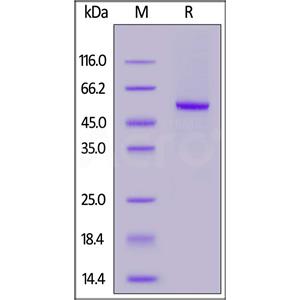 Biotinylated Human Carbonic Anhydrase IX / CA9 Protein