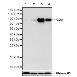 CD61 Recombinant Rabbit mAb (S-2515-6)