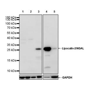 Lipocalin-2/NGAL Recombinant Rabbit mAb (S-2280-129)