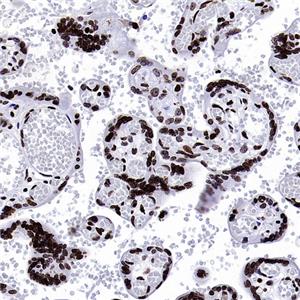 Cyclin E1 Recombinant Rabbit mAb (SDT-2512-182)