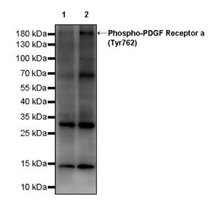 Phospho-PDGF Receptor α (Tyr762) Recombinant Rabbit mAb (S-3423)