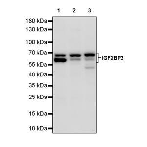 IGF2BP2 Rabbit Polyclonal Antibody