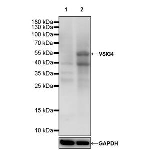 VSIG4 Recombinant Rabbit mAb (SDT-2737-61)