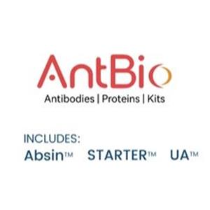 Rat Anti-Mouse CD144 Antibody (S-R719)