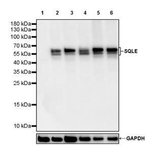 SQLE Recombinant Rabbit mAb (S-2358-207)