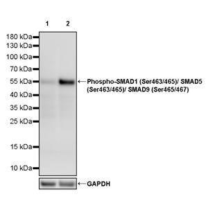 Phospho-SMAD1 (Ser463/465)/ SMAD5 (Ser463/465)/ SMAD9 (Ser465/467) Recombinant Rabbit mAb (S-3412)