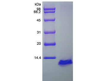 重组人活化调控正常T细胞表达序列/CCL5