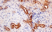 AMPK ALPHA 1 RABBIT MONOCLONAL ANTIBODY