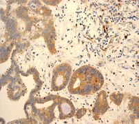 PHD1兔单克隆抗体